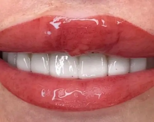 micropigmentacion Primer plano de unos labios rojos y brillantes, ligeramente separados, que revelan unos dientes blancos y brillantes. Realzados con brillo labial y micropigmentación, los labios lucen una apariencia suave y pulida. Monica Aranguez