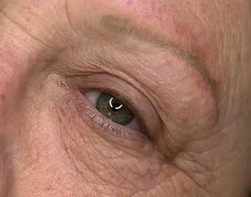 micropigmentacion Primer plano del ojo de una persona mayor, que muestra un iris verde y arrugas visibles alrededor del ojo. La ceja, que parece haberse sometido a micropigmentación, es apenas visible sobre el ojo. Monica Aranguez