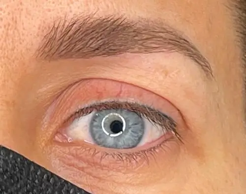 micropigmentacion Primer plano de un ojo azul con una ceja bien cuidada, realzada mediante micropigmentación de cejas. La persona lleva una máscara facial negra y un anillo de luz se refleja en el ojo. Monica Aranguez