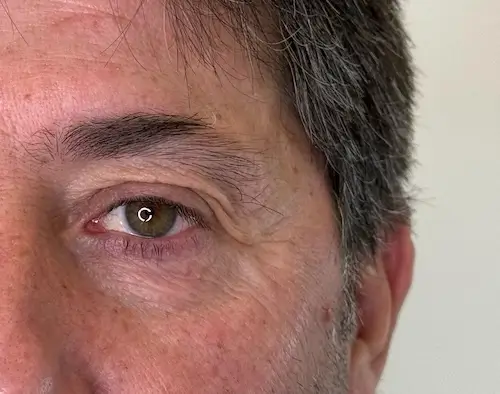 micropigmentacion Primer plano del ojo de un hombre, que revela un iris marrón verdoso con el reflejo de una ventana en la pupila. Su piel presenta arrugas y se aprecia un ligero vello facial, lo que sugiere una belleza natural incluso antes de los tratamientos de micropigmentación. Monica Aranguez