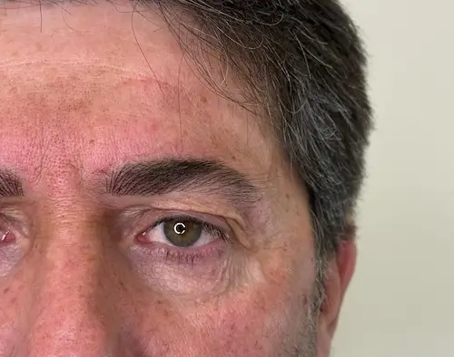micropigmentacion Primer plano del lado izquierdo del rostro de un hombre, donde se aprecian el ojo, la ceja, parte de la frente y el cabello. El hombre, posiblemente considerando tratamientos de micropigmentación, tiene el cabello castaño grisáceo y mira directamente a la cámara sobre un fondo claro y liso. Monica Aranguez