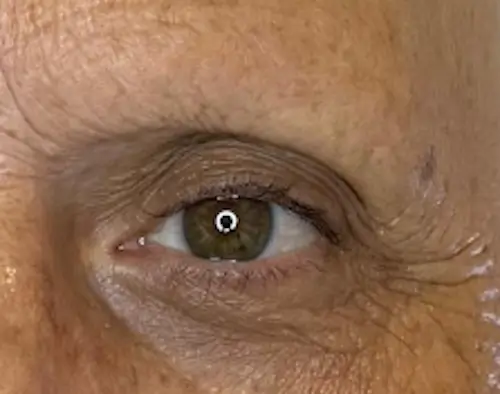 micropigmentacion Primer plano del ojo de una persona mayor que muestra un iris marrón, arrugas circundantes y piel texturizada. Los sutiles resultados de la micropigmentación de cejas realzan la ceja, mientras que la iluminación resalta los detalles de la piel y el reflejo circular en la pupila. Monica Aranguez