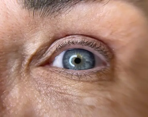 micropigmentacion Primer plano de un ojo azul con pestañas visibles y textura de la piel, que muestra los delicados resultados de la micropigmentación ocular. El iris presenta tonos azules claros y oscuros, mientras que la pupila refleja una fuente de luz circular. Monica Aranguez