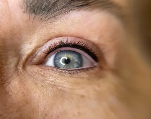 micropigmentacion Primer plano de un ojo azul con pestañas visibles y una textura detallada de la piel alrededor del ojo, incluyendo líneas de expresión y poros. El ojo está bien abierto, mostrando los resultados de la micropigmentación ocular, con luz reflejada en la pupila. Monica Aranguez