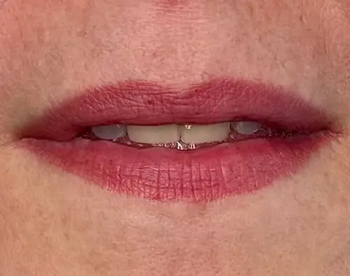 micropigmentacion Primer plano de los labios de una persona con lápiz labial rojo rosado, ligeramente separados para revelar los dientes superiores e inferiores. La textura natural de la piel y los poros visibles resaltan el efecto de la micropigmentación labial. Monica Aranguez