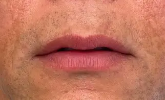 micropigmentacion Primer plano de la boca y los labios de una persona con tono de piel claro, algo de vello facial y textura de piel visible. Ideal para mostrar resultados de tratamientos de micropigmentación para hombre, con labios cerrados y relajados. Monica Aranguez