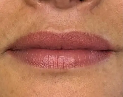 micropigmentacion Una vista de cerca de la mitad inferior del rostro de una persona, que muestra unos labios suaves y de color natural y parte de la piel circundante, resalta los efectos sutiles de la micropigmentación en labios. Monica Aranguez