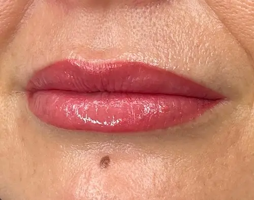 micropigmentacion Primer plano de labios rosados brillantes, realzados mediante micropigmentación labial. La piel alrededor de los labios es lisa, con un pequeño lunar marrón centrado debajo del labio inferior. Monica Aranguez